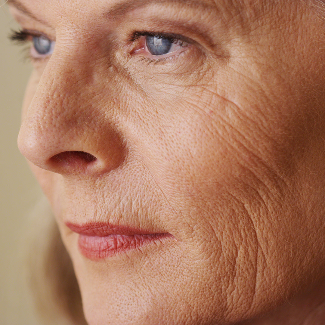 Help! My pores are getting larger as I age