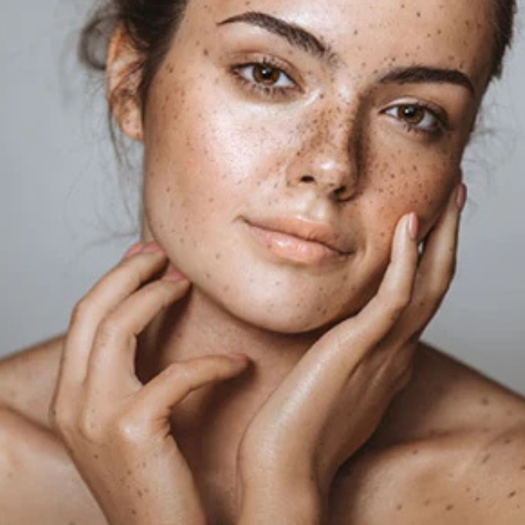 Does Retinol help with hyperpigmentation?