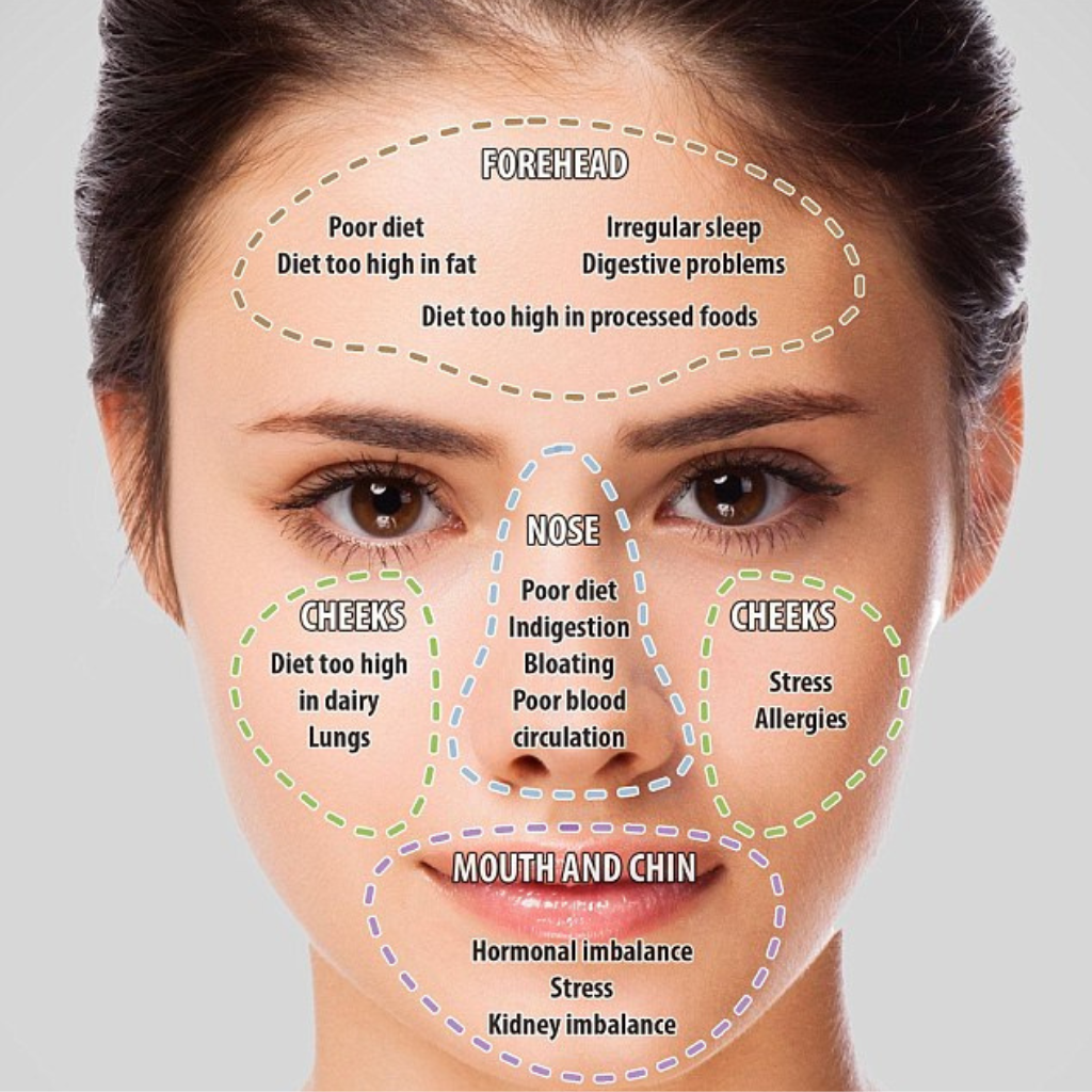 Face Mapping. What the location of your blemishes is telling you